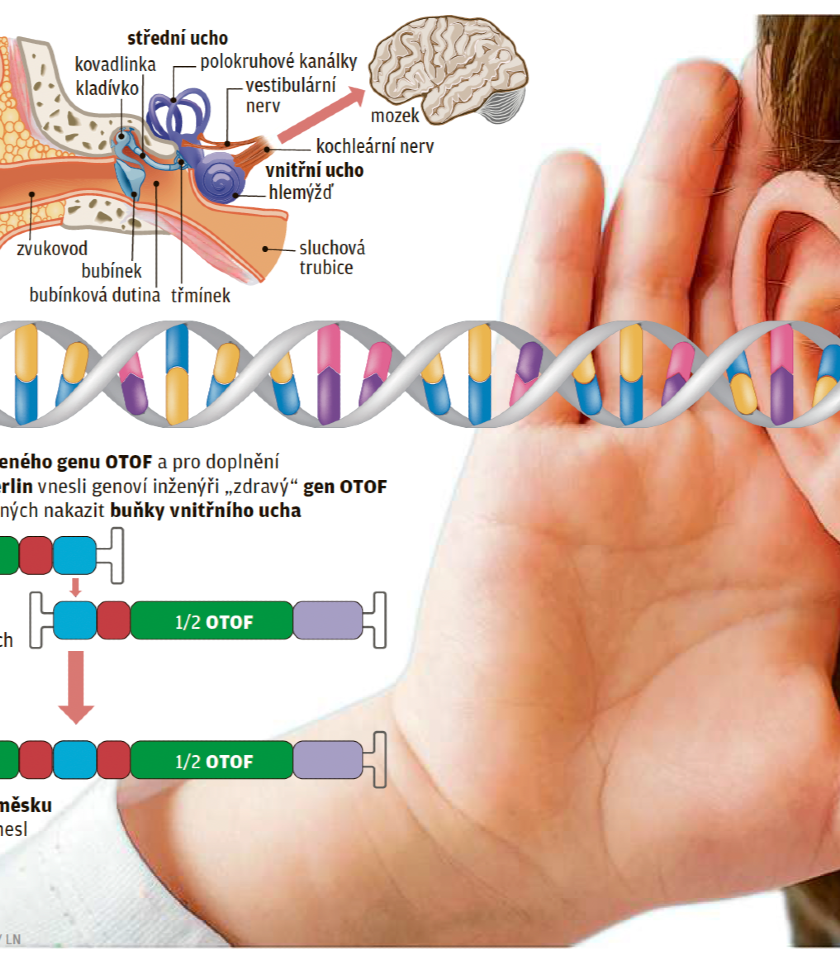 Genetikům se podařilo vrátit sluch u osob s vrozenou hluchotou