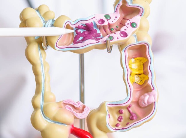 We are introducing two new screening tests for colon and lung cancer.